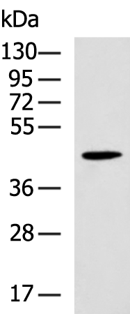 Rabbit Polyclonal Antibody to WNT10B