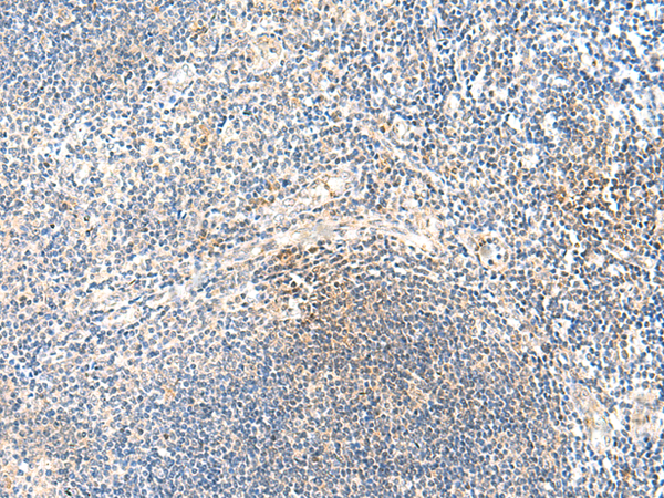 Rabbit Polyclonal Antibody to XPC