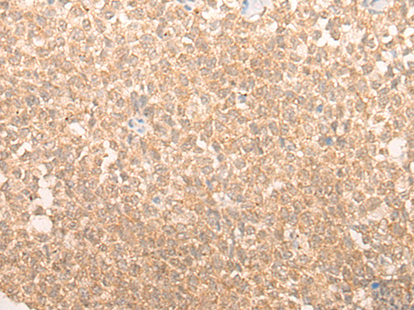 Rabbit Polyclonal Antibody to YAP1