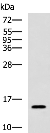 Rabbit Polyclonal Antibody to ZFAND2A