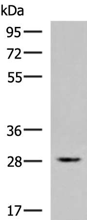 Rabbit Polyclonal Antibody to ZFAND2B