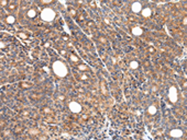 Rabbit Polyclonal Antibody to ZFP30