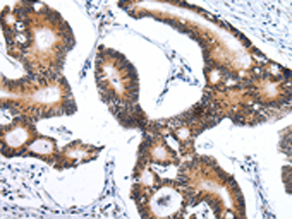 Rabbit Polyclonal Antibody to ZNF473