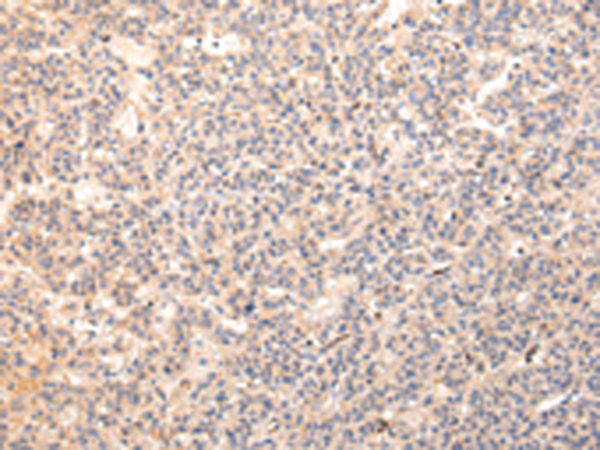 Rabbit Polyclonal Antibody to ZPR1
