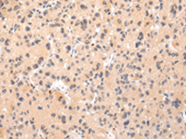 Rabbit Polyclonal Antibody to IKZF4