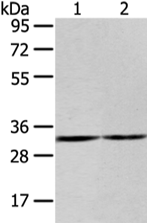 Rabbit Polyclonal Antibody to ZNF146