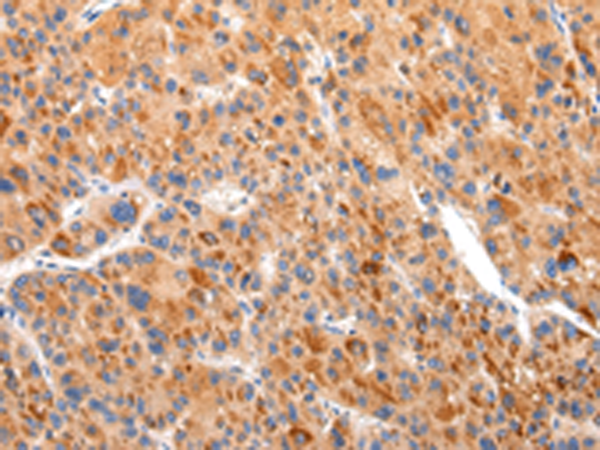 Rabbit Polyclonal Antibody to BSN