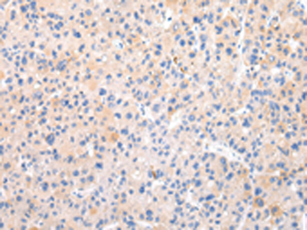 Rabbit Polyclonal Antibody to ZNF420