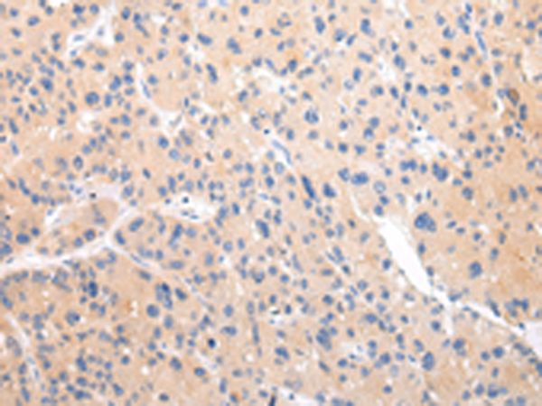 Rabbit Polyclonal Antibody to ZNF106