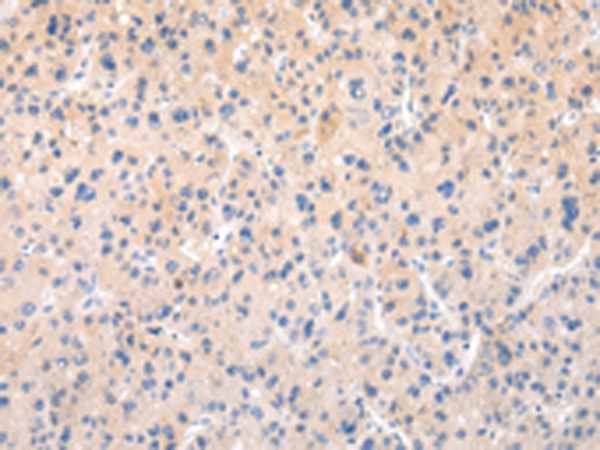 Rabbit Polyclonal Antibody to APLN