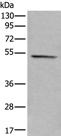 Rabbit Polyclonal Antibody to KRT7