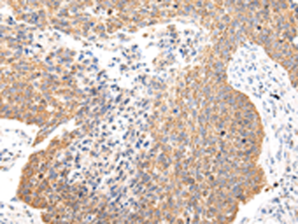 Rabbit Polyclonal Antibody to COL8A2