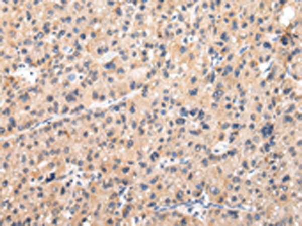Rabbit Polyclonal Antibody to MUC1(NT)