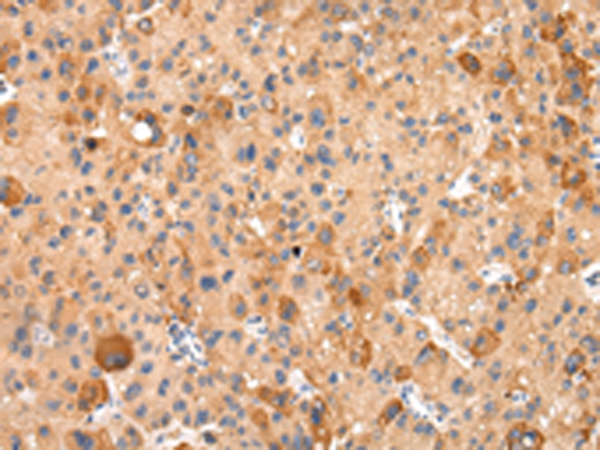 Rabbit Polyclonal Antibody to AQP7