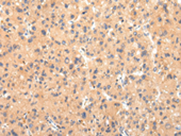 Rabbit Polyclonal Antibody to ATP7B