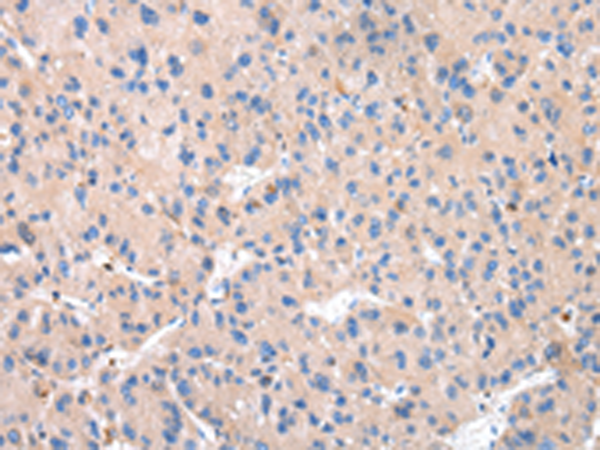 Rabbit Polyclonal Antibody to CTSK