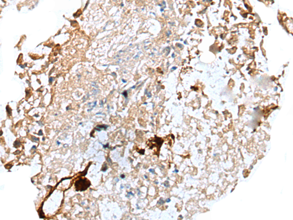 Rabbit Polyclonal Antibody to CTSS