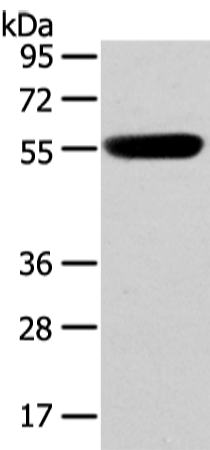 Rabbit Polyclonal Antibody to CBX4