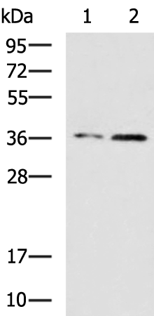 Rabbit Polyclonal Antibody to CBX7