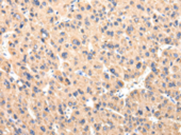 Rabbit Polyclonal Antibody to CCL7