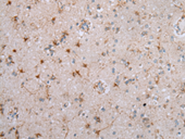 Rabbit Polyclonal Antibody to CCR6