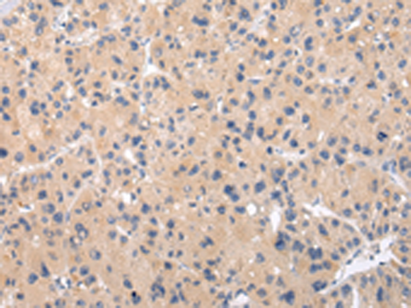 Rabbit Polyclonal Antibody to CHRM5
