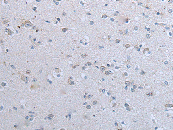 Rabbit Polyclonal Antibody to CLDN12