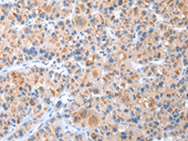 Rabbit Polyclonal Antibody to CXCR4