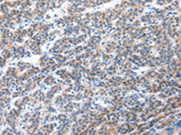 Rabbit Polyclonal Antibody to CFC1