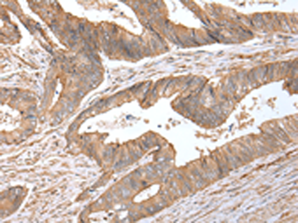 Rabbit Polyclonal Antibody to ACVRL1