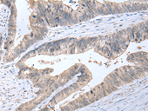 Rabbit Polyclonal Antibody to ALDH2