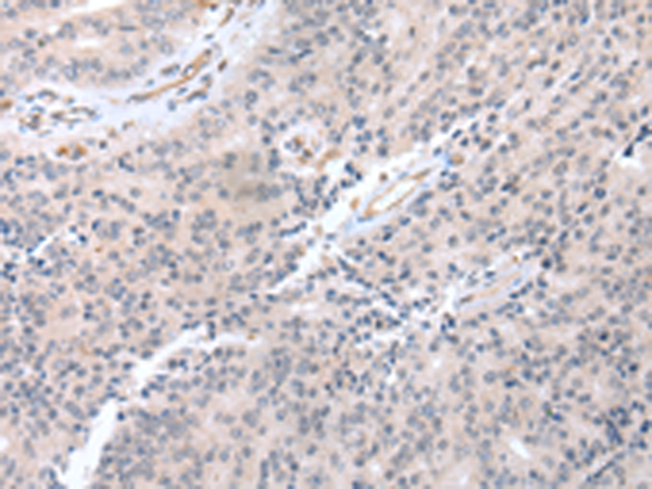 Rabbit Polyclonal Antibody to CCR10