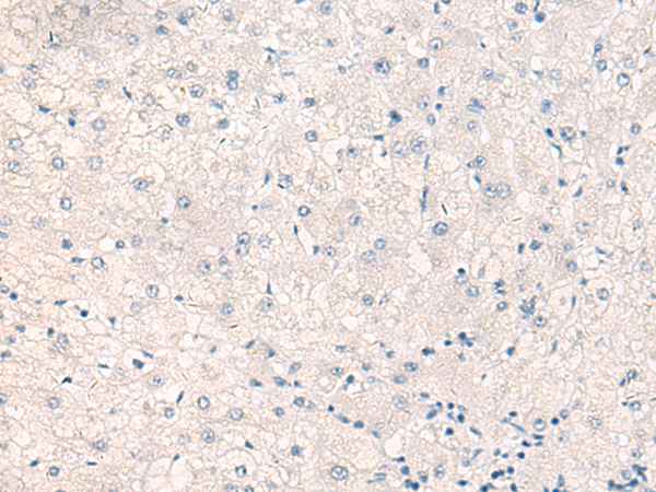 Rabbit Polyclonal Antibody to CEBPB