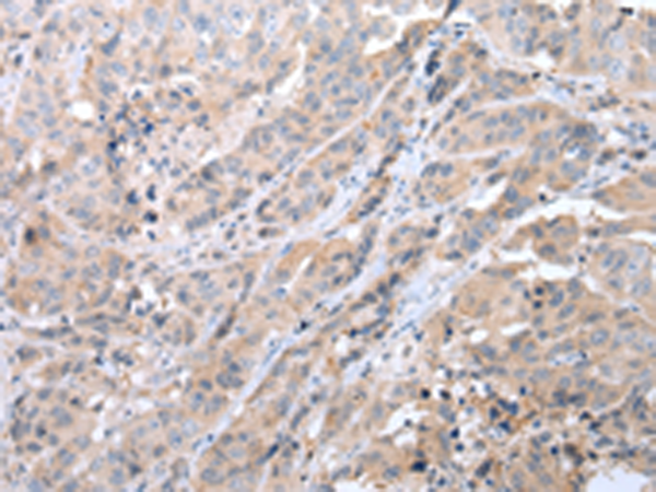 Rabbit Polyclonal Antibody to GJC1