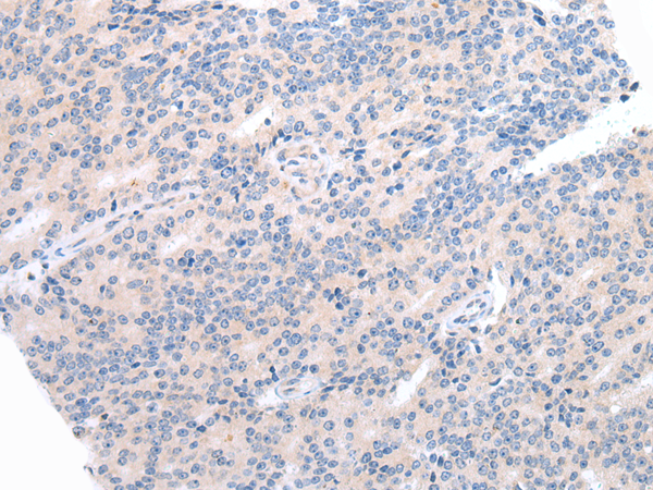 Rabbit Polyclonal Antibody to AQP9