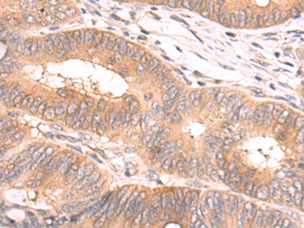 Rabbit Polyclonal Antibody to IL18RAP