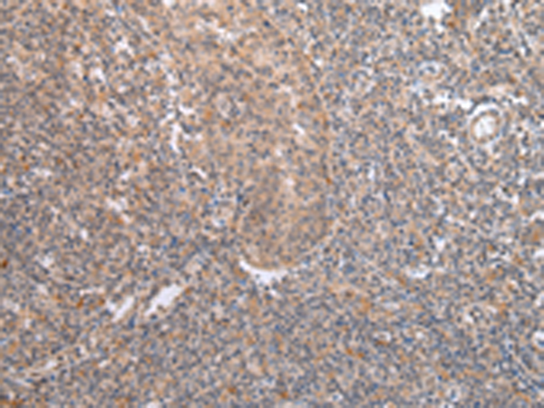 Rabbit Polyclonal Antibody to DVL1