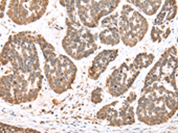 Rabbit Polyclonal Antibody to DDX58