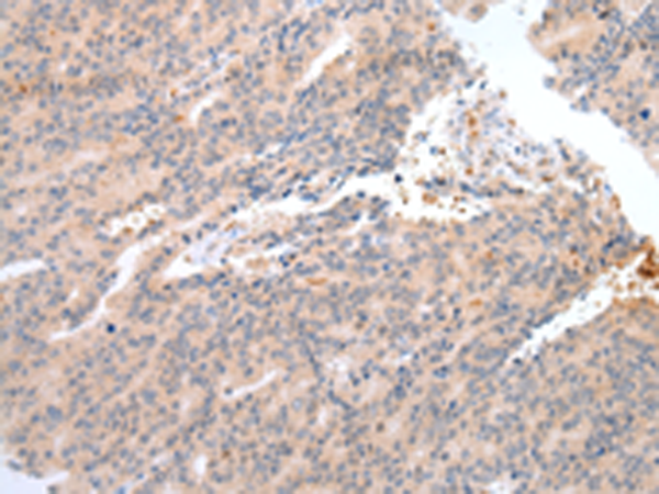 Rabbit Polyclonal Antibody to DEFB4A