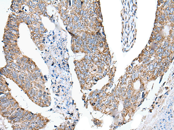 Rabbit Polyclonal Antibody to DEFB104A