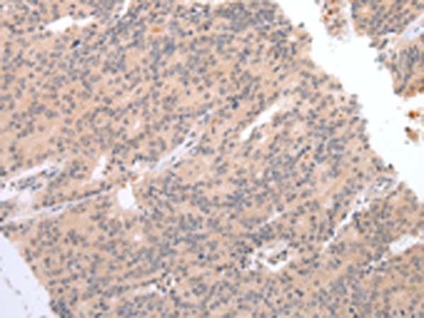 Rabbit Polyclonal Antibody to DEFB112
