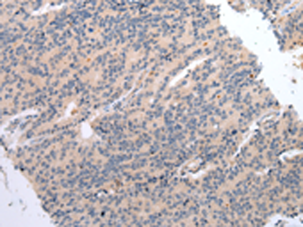 Rabbit Polyclonal Antibody to DVL3