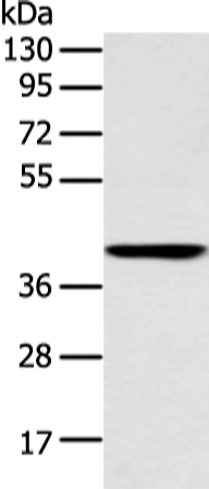 Rabbit Polyclonal Antibody to E2F1