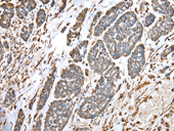 Rabbit Polyclonal Antibody to SPINK7