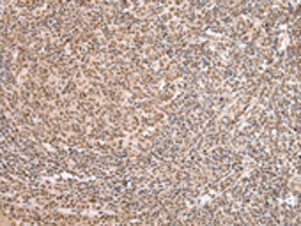 Rabbit Polyclonal Antibody to FOXG1