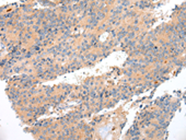 Rabbit Polyclonal Antibody to ENPP1