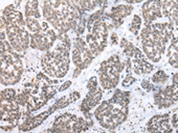 Rabbit Polyclonal Antibody to PTGER3