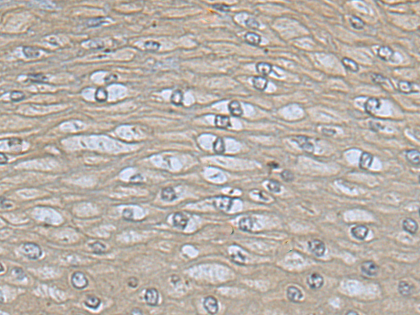 Rabbit Polyclonal Antibody to EPHA2