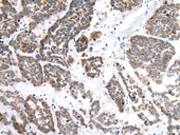 Rabbit Polyclonal Antibody to EPHB1