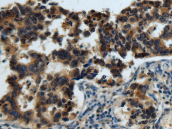 Rabbit Polyclonal Antibody to EPHB4